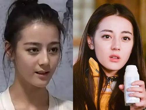 明星是如何变白的,揭秘明星肌肤白皙的秘诀